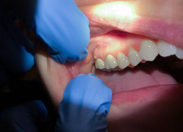 Best Emergency TMJ Treatment in Altadena, CA